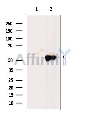 Валидация Affinity DF13918 - 9658