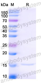 Валидация SDS-PAGE - AntibodySystem RVV03102