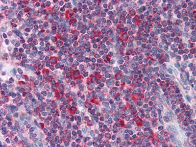 Валидация AntibodySystem RHN88905
