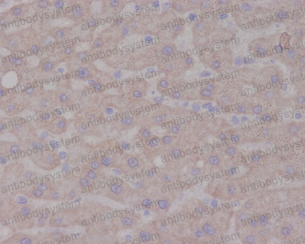 Валидация AntibodySystem RHC09801