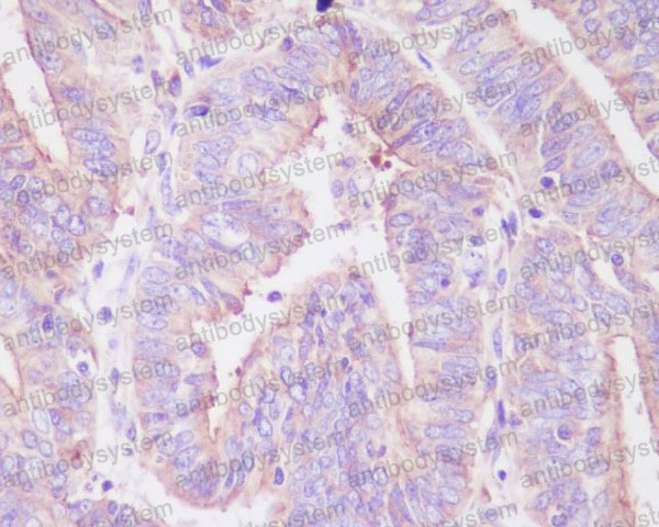Валидация AntibodySystem RHA69802