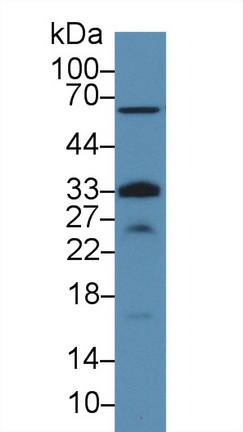 13926