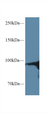 14542