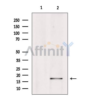 Валидация Affinity DF8592 - 20506