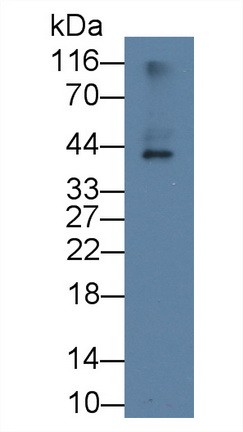 18566