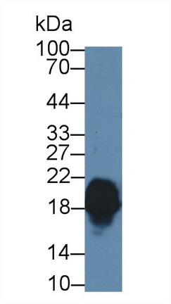 8721