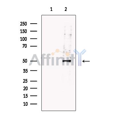 Валидация Affinity DF13707 - 9320