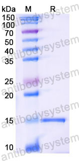 Валидация SDS-PAGE - AntibodySystem RHB10201
