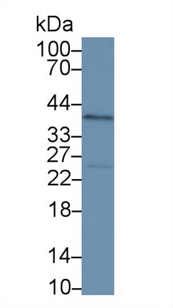 9587