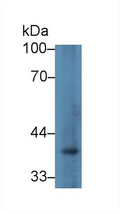 13821
