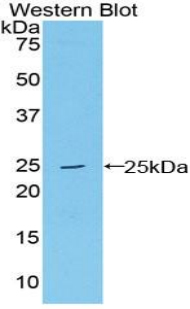 52374
