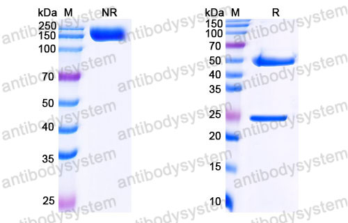 Валидация SDS-PAGE - AntibodySystem DHJ48302