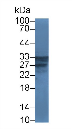 14933