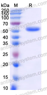 EWD68901, SDS-PAGE