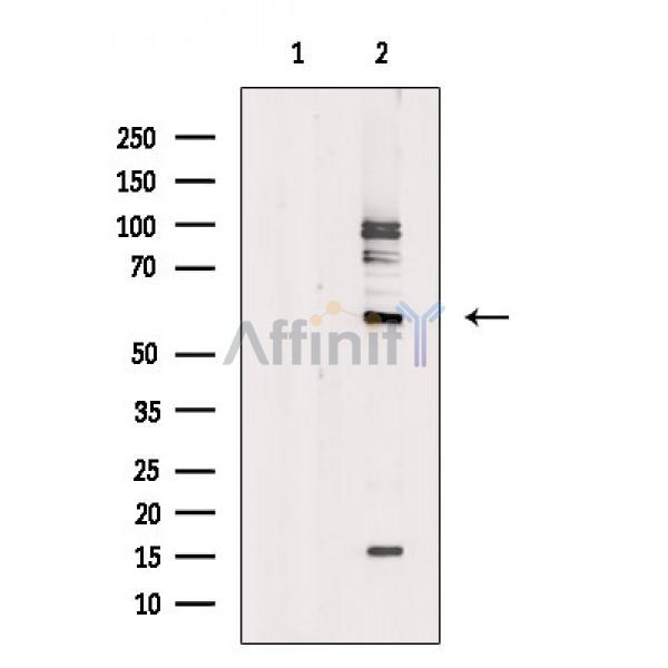 Валидация Affinity DF2218 - 12747