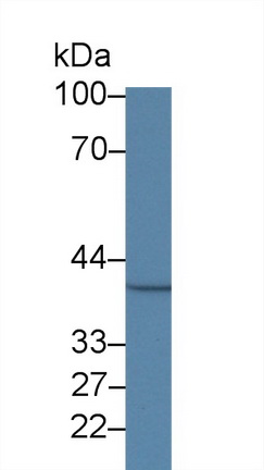 14454