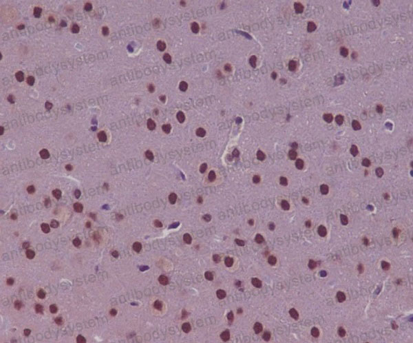 Валидация AntibodySystem RHA49802