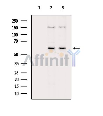 Валидация Affinity DF15529 - 11913