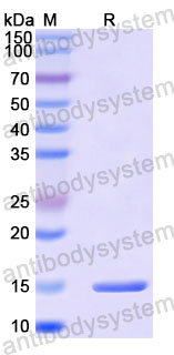 Валидация SDS-PAGE - AntibodySystem RWN10303