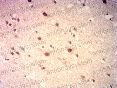 Валидация AntibodySystem RHC30501 (867)