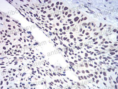 Валидация AntibodySystem RHJ34202 (3379)