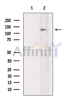 Валидация Affinity DF14961 - 11154