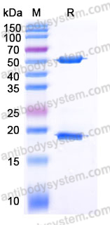 YHE27702, SDS-PAGE