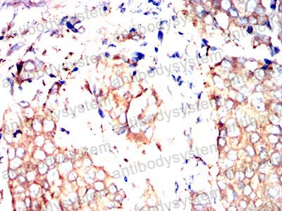 Валидация AntibodySystem RHN05103 (3783)