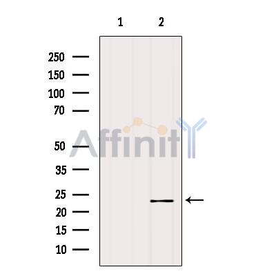 Валидация Affinity DF9242 - 21666