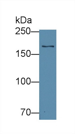 12787