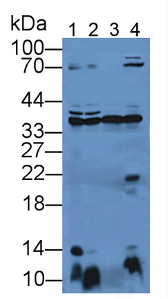 11938