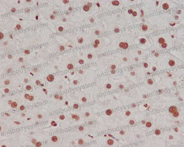 Валидация AntibodySystem RHF62716