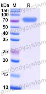 EHC39803, SDS-PAGE