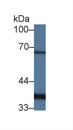 14301