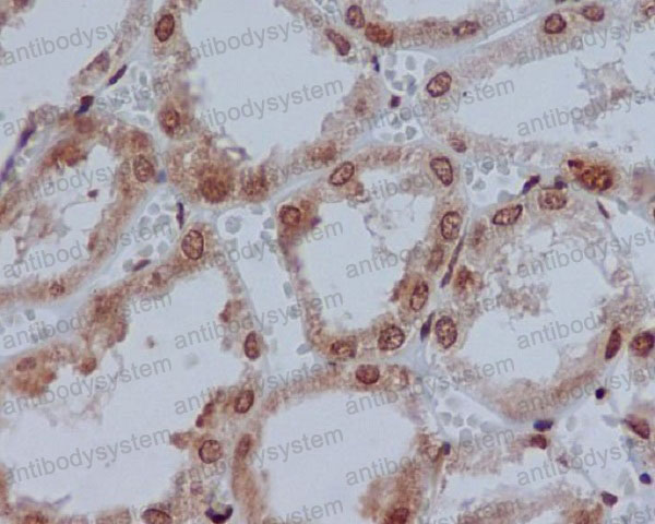 Валидация AntibodySystem RHF61301