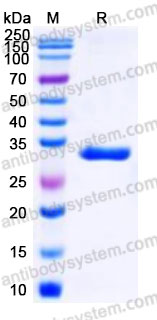 YHE75202, SDS-PAGE