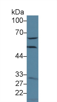 13912