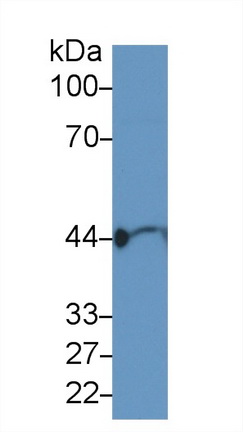 15261