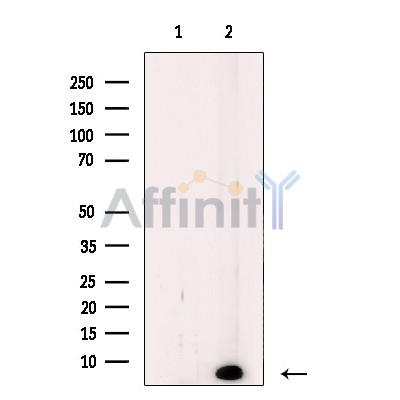 Валидация Affinity DF2395 - 12986