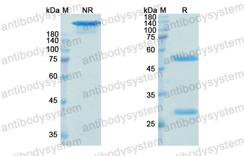 Валидация SDS-PAGE - AntibodySystem DGK07802