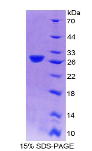 56332