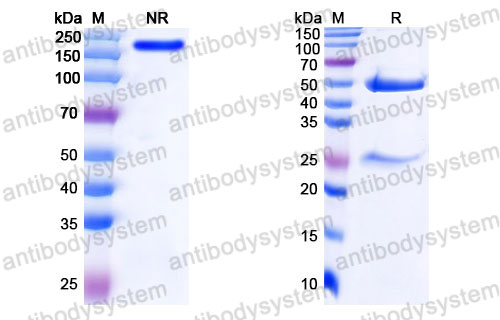 Валидация SDS-PAGE - AntibodySystem FMB96720