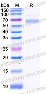 EHH29101, SDS-PAGE