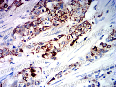 Валидация AntibodySystem RHA04202 (12)