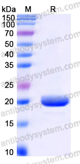 EHJ41202, SDS-PAGE