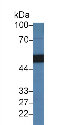 14364