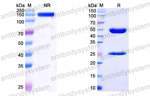 Валидация SDS-PAGE - AntibodySystem FRJ92830