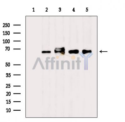 Валидация Affinity DF3948 - 15150