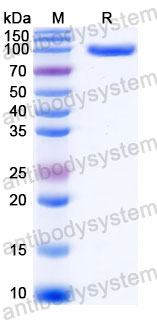 EHC31701, SDS-PAGE