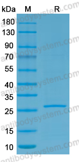 YVV47701, SDS-PAGE